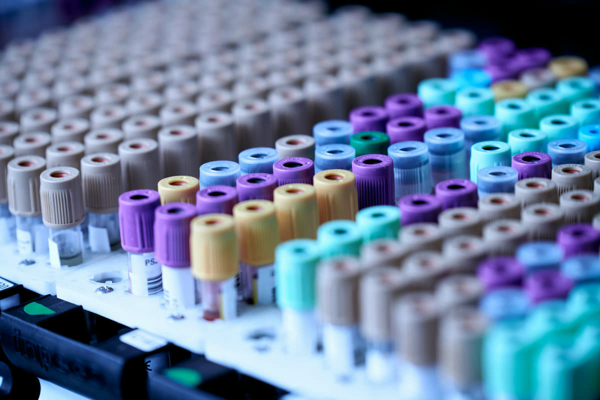 Blood collection tubes in a laboratory rack, prepared for platelet-rich fibrin processing